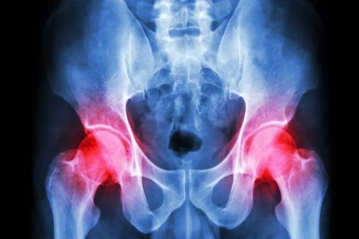 Pijn aan je heup? Met deze tips kom je er weer van af!