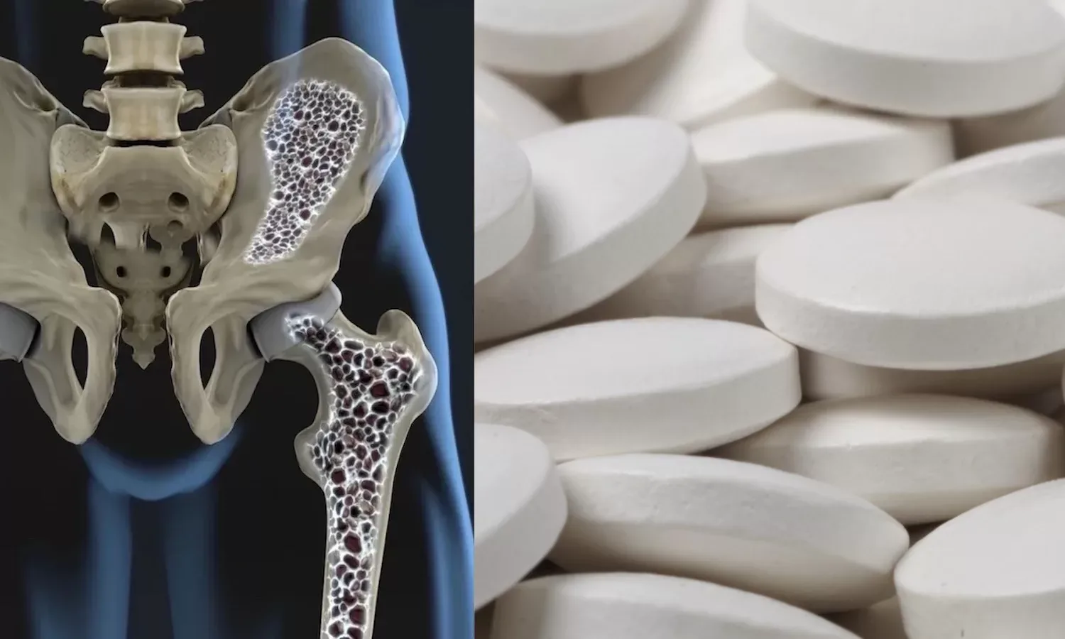 Van medicijnen tot ouderdom: dít zijn de meest voorkomende oorzaken van osteoporose!