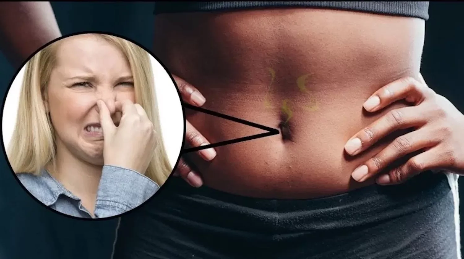 Last van een vieze geur uit jouw navel? Dit moet je erover weten