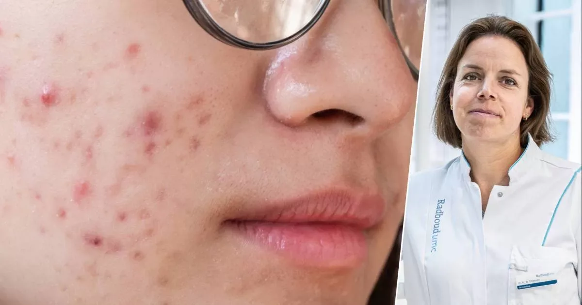 Dermatologen waarschuwen: deze voedingsmiddelen eten wij niet! (en ik nu ook niet meer)