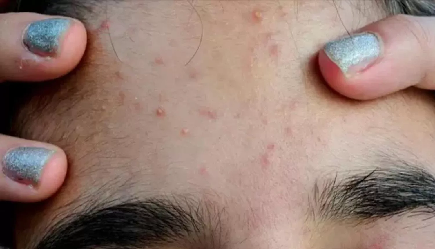 LET OP: Negeer deze 6 waarschuwingssignalen van je lever niet!