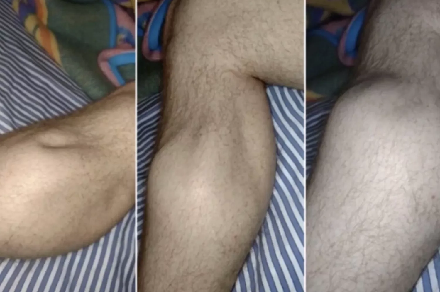 Krampen in kuiten en tenen tijdens het slapen? Dit is hoe je er snel weer vanaf komt