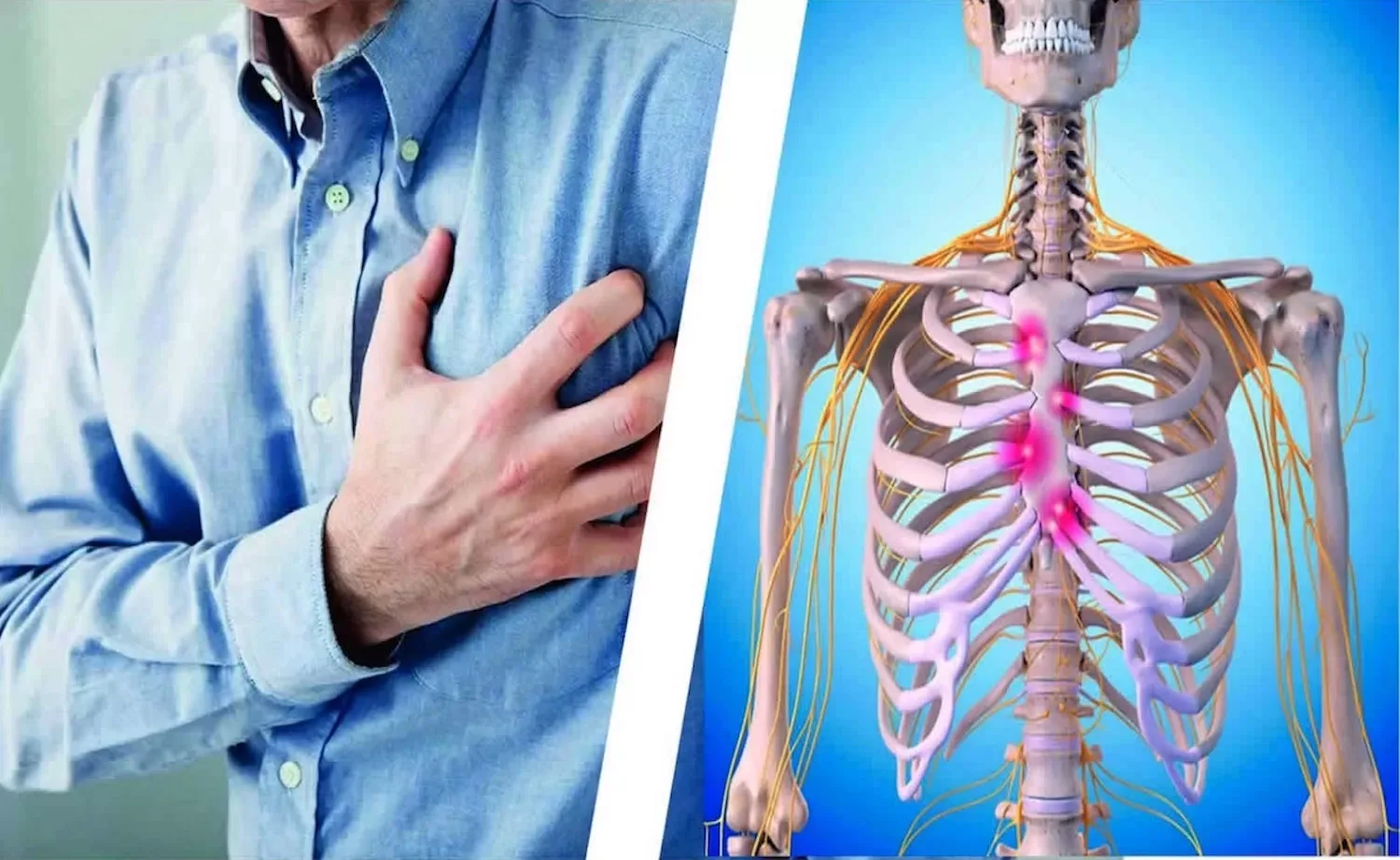 Pijn op je borst? Dat kan mogelijk wijzen op DIT syndroom!