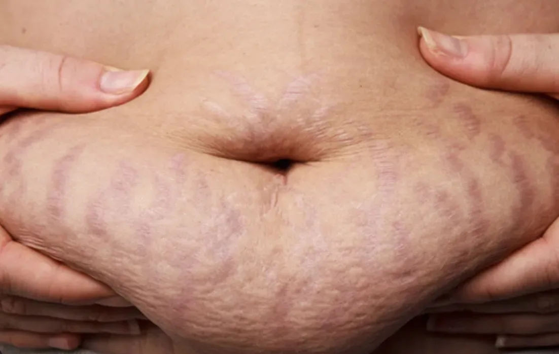 LET OP: Dit geheime drankje helpt je om binnen enkele weken van buikvet af te komen