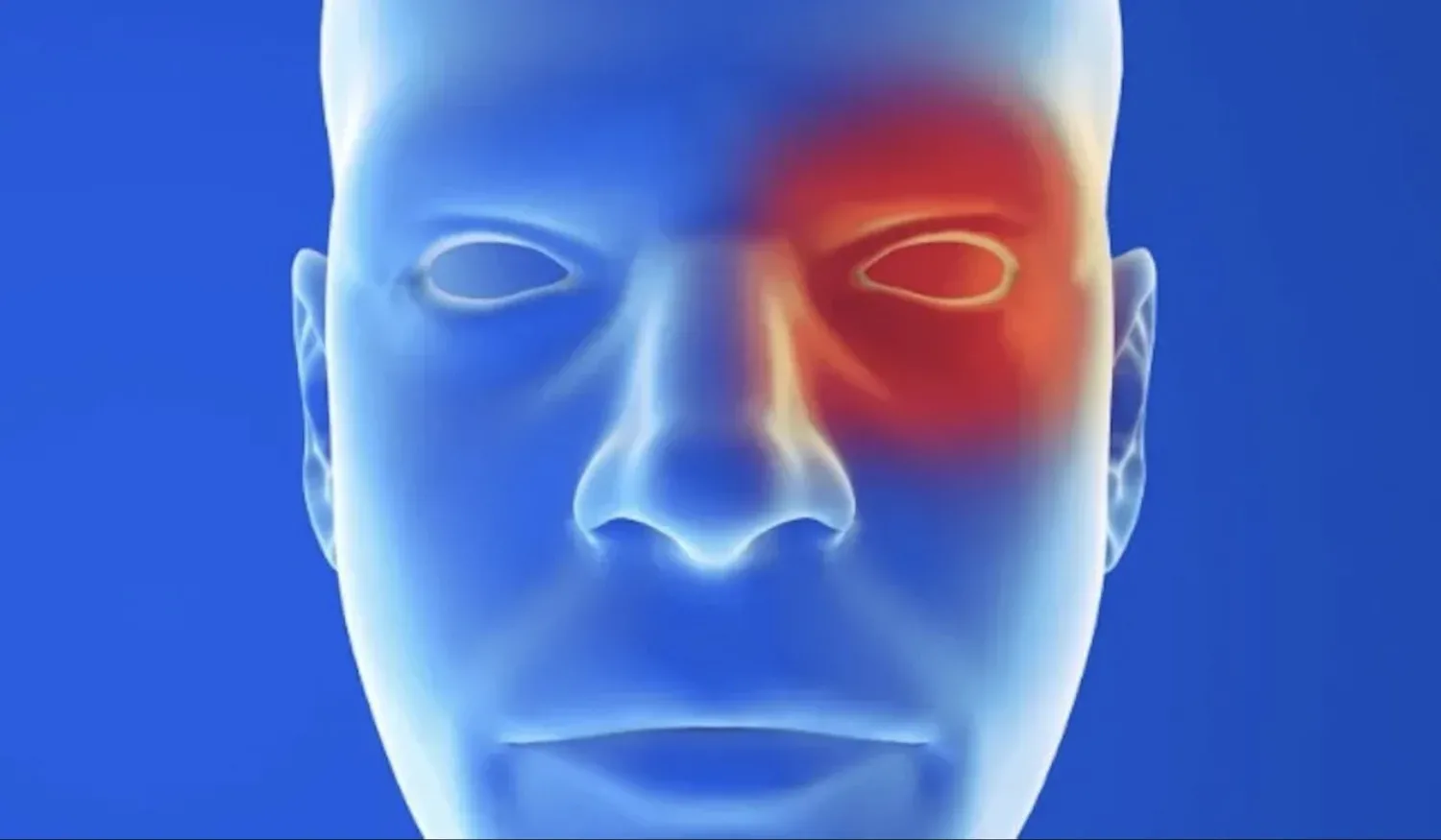 Clusterhoofdpijn: dit zijn de (onbewuste) symptomen. En zo kom je er vanaf!