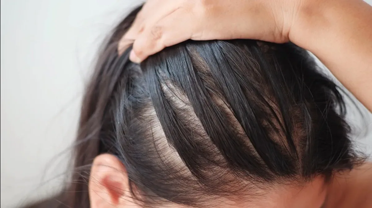 Let op! Deze 7 gewoontes zorgen voor steeds dunner wordend haar!