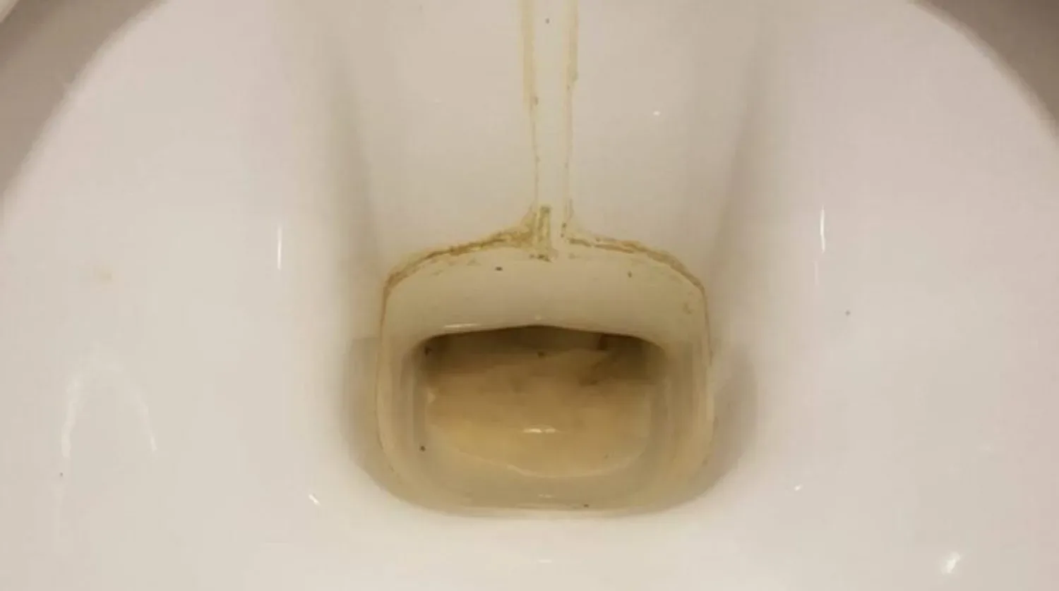 Met deze huismiddelen voorkom je bruine aanslag