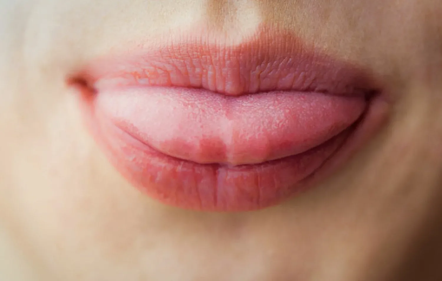 Tintelt je mond na het eten van bepaald fruit? Dít is de reden!