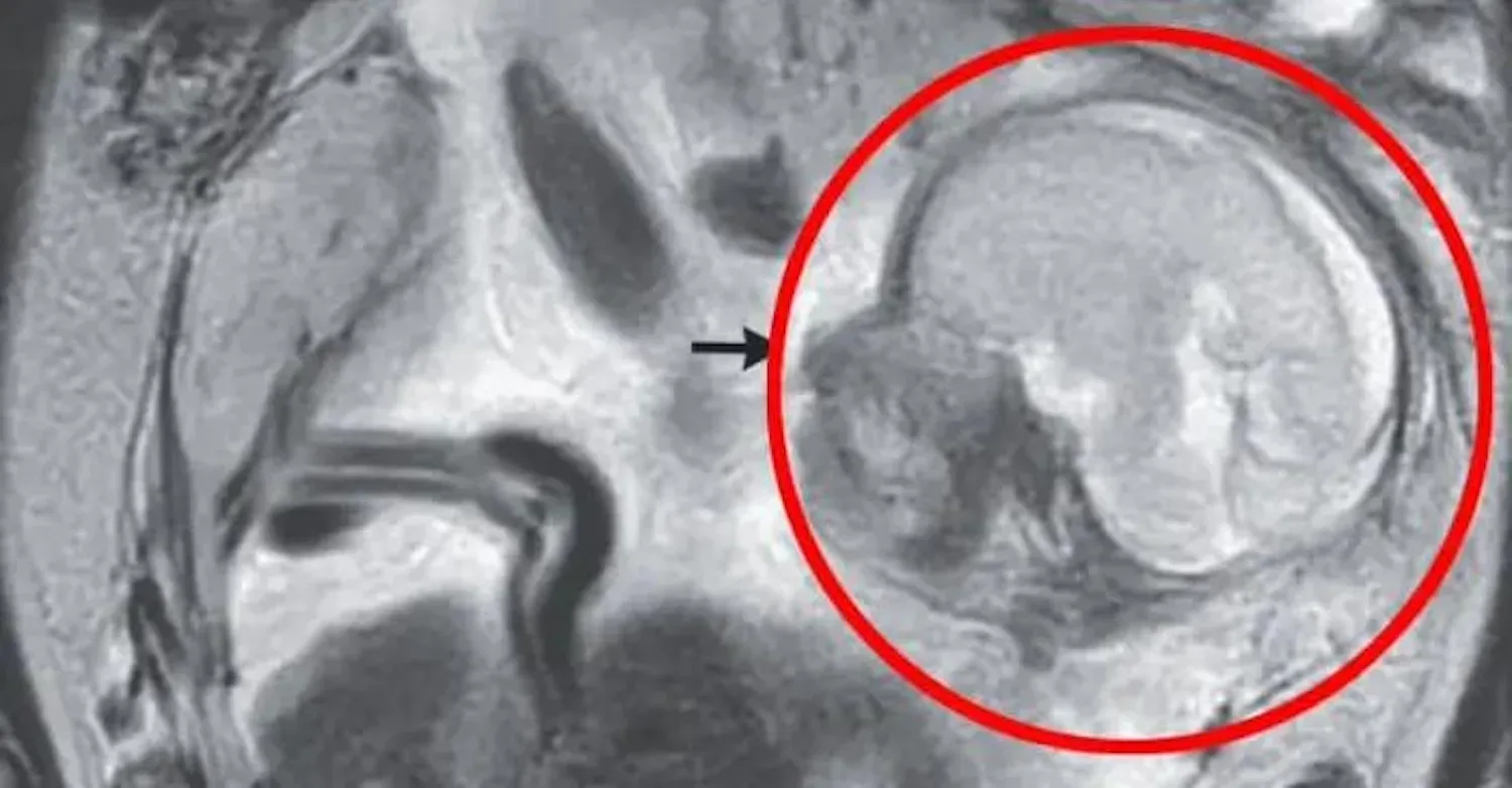 Vrouw klaagt bij dokter over maagkrampen, maar krijgt daarna het schokkende nieuws