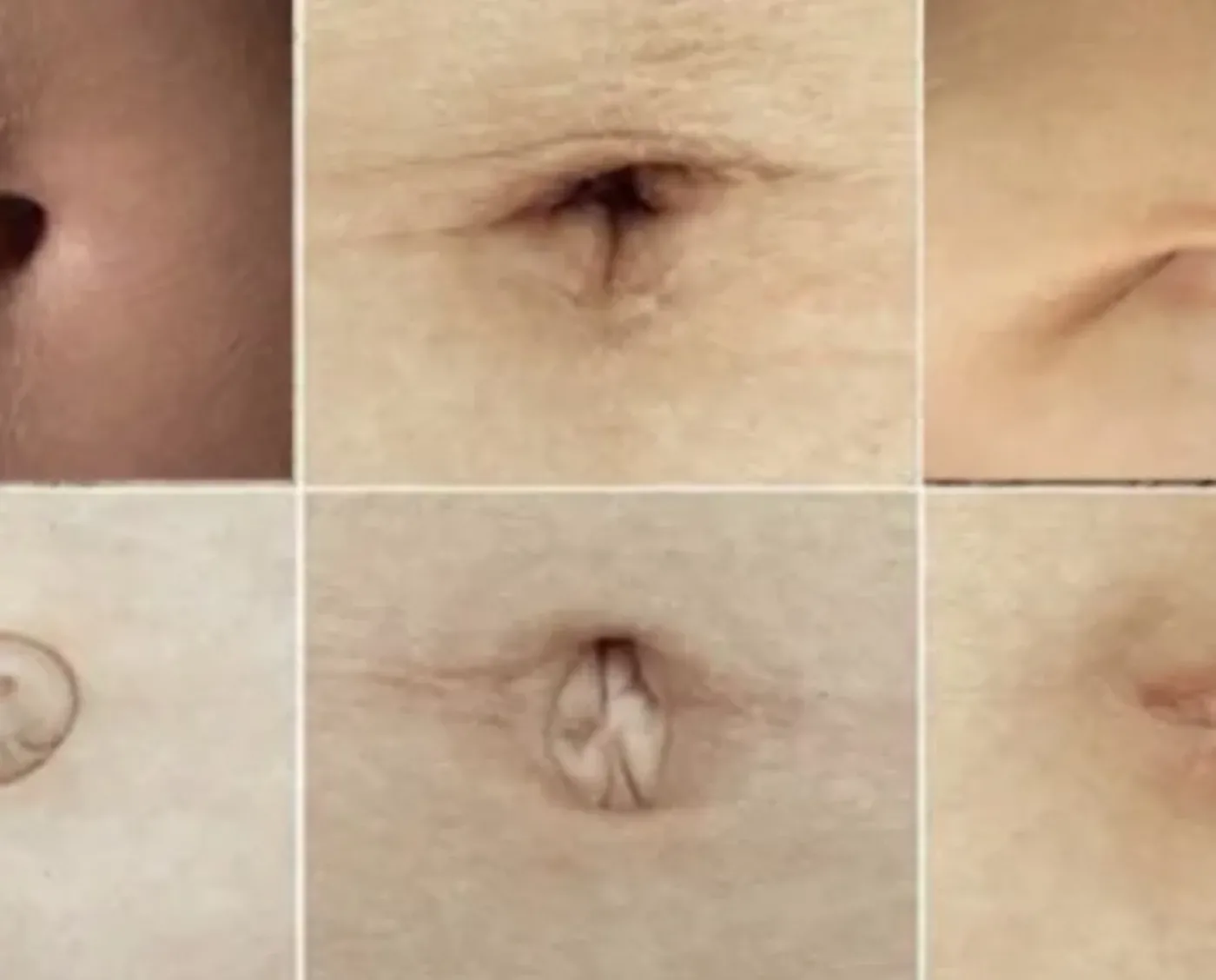 Dit is wat het soort navel dat je hebt vertelt over je persoonlijkheid