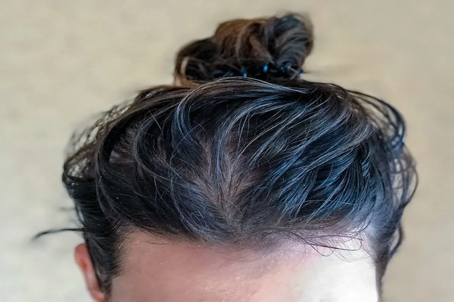 Snel last van vet haar? Deze 7 trucs helpen!