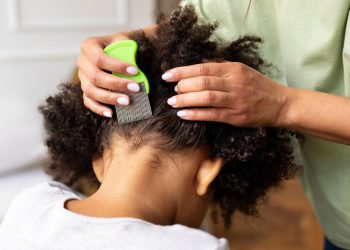 Vader vraagt ​​om hulp bij het beheren van het haar van zijn dochter en maakt zijn ex-vrouw boos