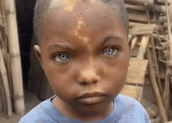 Kleine jongen met natuurlijk blauwe ogen, witte haartjes en een bliksemschicht op gezicht gaat viraal