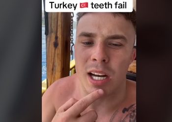 Nieuw gebitje laten zetten in Turkije gaat helemaal fout “Wat een nachtmerrie”