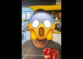 Foto: Bebloede Dave Roelvink deelt beelden nadat hij flink in elkaar is geslagen; ‘Fijne zondag’