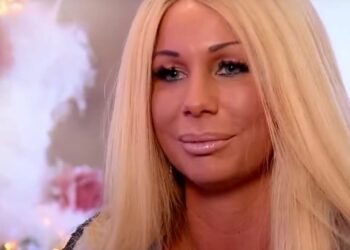 Samantha de Jong (Barbie) is compleet onherkenbaar na  gezichtsbehandeling