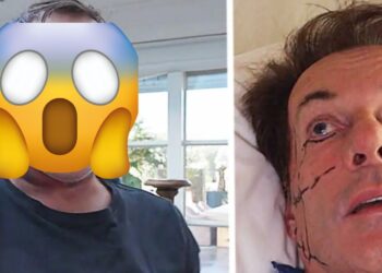 Gerard Joling verrast fans met ingrijpende plastische chirurgie: “Niet meer te herkennen”