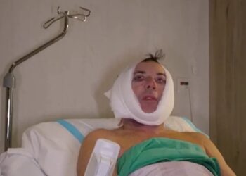 Gerard Joling neem groot risico met cosmetische operatie: “Groot risico op verlamming”