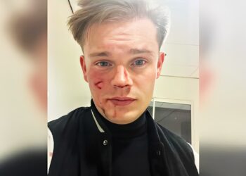 Onze gedachten gaan momenteel uit naar Dennis Schouten