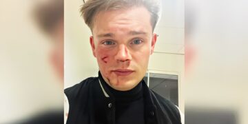 Onze gedachten gaan momenteel uit naar Dennis Schouten